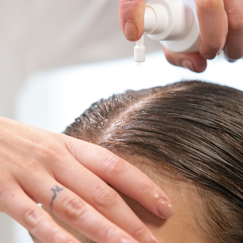 Woman using a scalp treatment