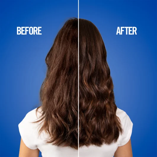 UniqOne Treatment