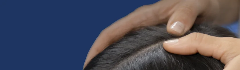 Scalp detox